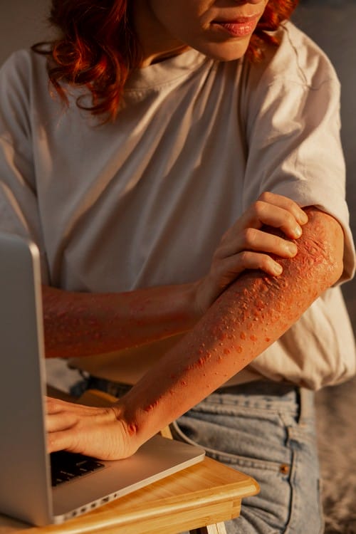 rats-in-san-antonio-texas woman experiencing skin disease